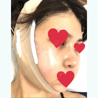 2日目の経過画像（3枚目）