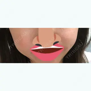 371日目の経過画像（1枚目）