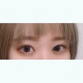 459日目の経過画像（2枚目）