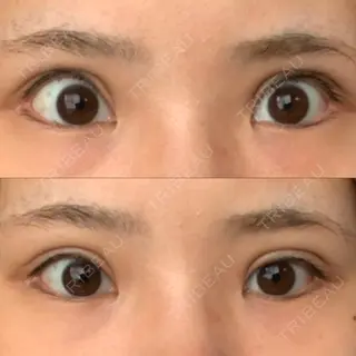 98日目の経過画像（1枚目）