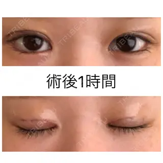 0日目の経過画像（1枚目）