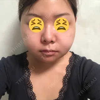 2日目の経過画像（1枚目）