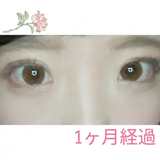 31日目の経過画像（1枚目）