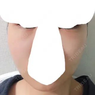 2日目の経過画像（1枚目）