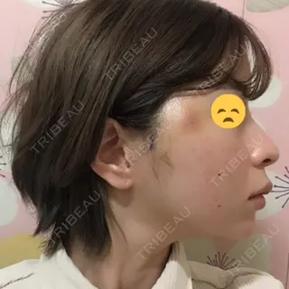 2日目の経過画像（2枚目）
