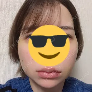 7日目の経過画像（1枚目）