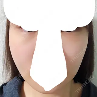 3日目の経過画像（1枚目）