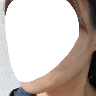 3日目の経過画像（2枚目）