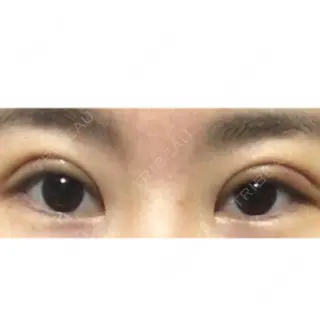 7日目の経過画像（1枚目）