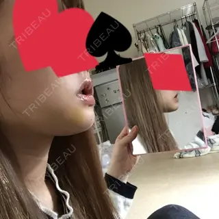5日目の経過画像（1枚目）