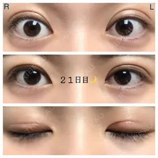 21日目の経過画像（1枚目）