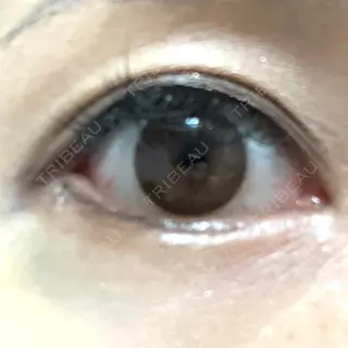 10日目の経過画像（1枚目）