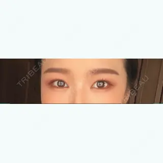 698日目の経過画像（2枚目）