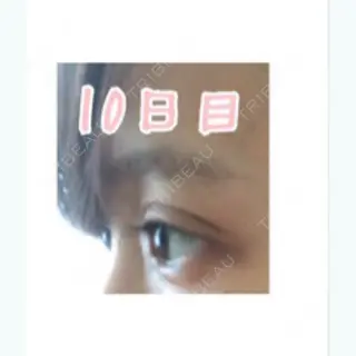 9日目の経過画像（2枚目）
