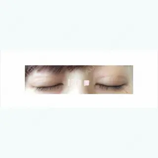 14日目の経過画像（2枚目）