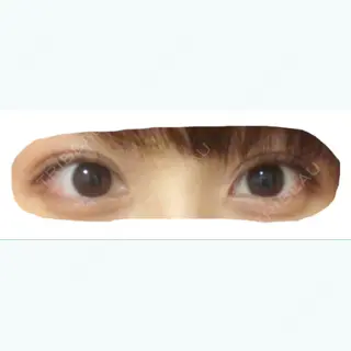 92日目の経過画像（1枚目）
