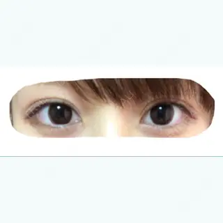 245日目の経過画像（1枚目）