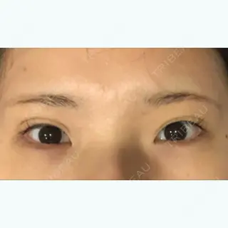 21日目の経過画像（1枚目）