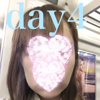 4日目の経過画像（1枚目）