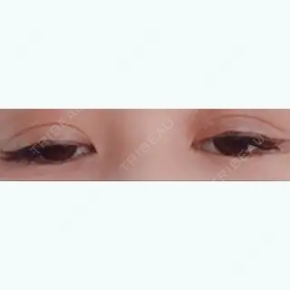 73日目の経過画像（2枚目）