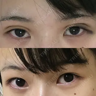 2日目の経過画像（1枚目）