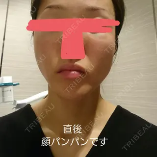 0日目の経過画像（2枚目）