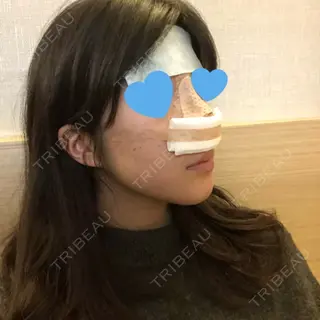 1日目の経過画像（1枚目）