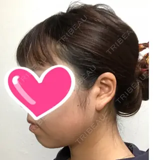 21日目の経過画像（1枚目）