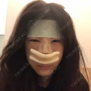 2日目の経過画像（1枚目）