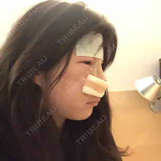 2日目の経過画像（2枚目）