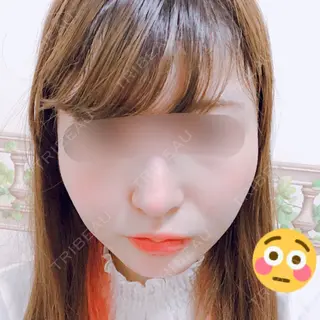 1日目の経過画像（1枚目）
