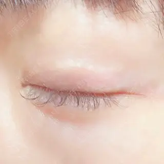 521日目の経過画像（2枚目）