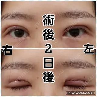 2日目の経過画像（1枚目）