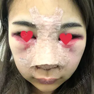 2日目の経過画像（1枚目）