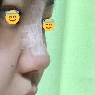 3日目の経過画像（2枚目）