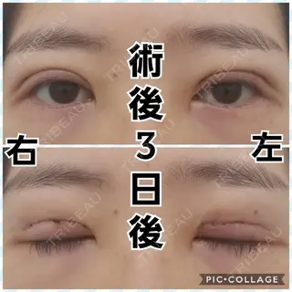 3日目の経過画像（1枚目）