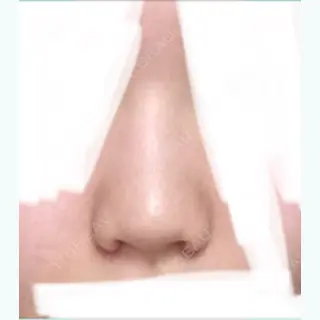8日目の経過画像（1枚目）
