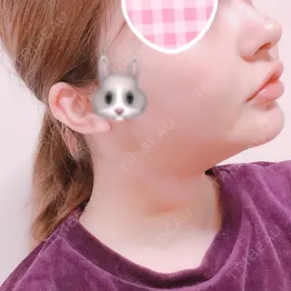 4日目の経過画像（2枚目）