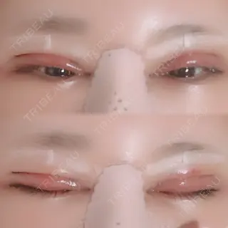 2日目の経過画像（1枚目）