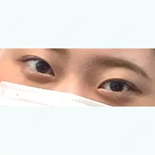 533日目の経過画像（1枚目）
