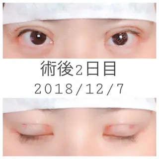 2日目の経過画像（1枚目）