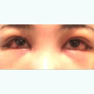2日目の経過画像（2枚目）