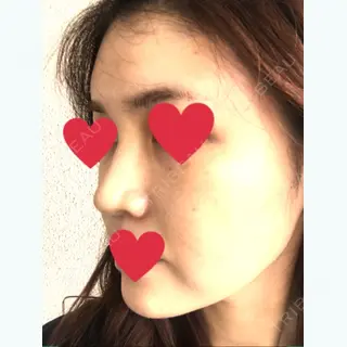 10日目の経過画像（2枚目）