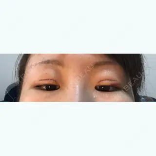 3日目の経過画像（3枚目）