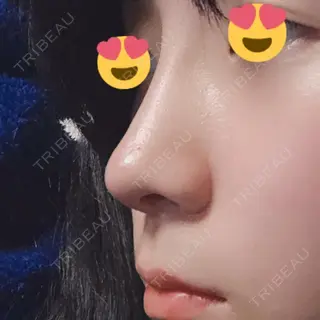 10日目の経過画像（3枚目）