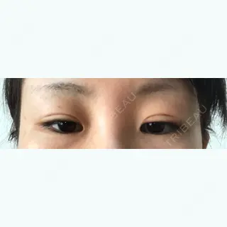 9日目の経過画像（2枚目）