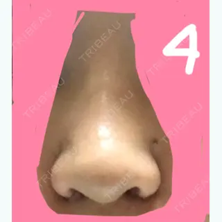 4日目の経過画像（1枚目）