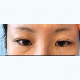 10日目の経過画像（2枚目）
