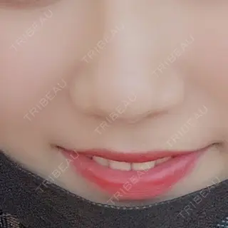 537日目の経過画像（1枚目）