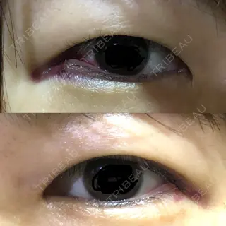 2日目の経過画像（2枚目）